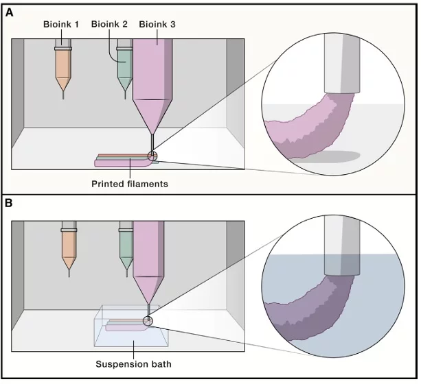Proceso de bioimpresión por extrusión. Fuente: Daly et al., (2021).